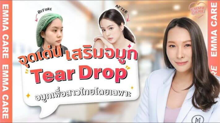 จุดเด่นเสริมจมูก Tear Drop จมูกเพื่อสาวไทยโดยเฉพาะ