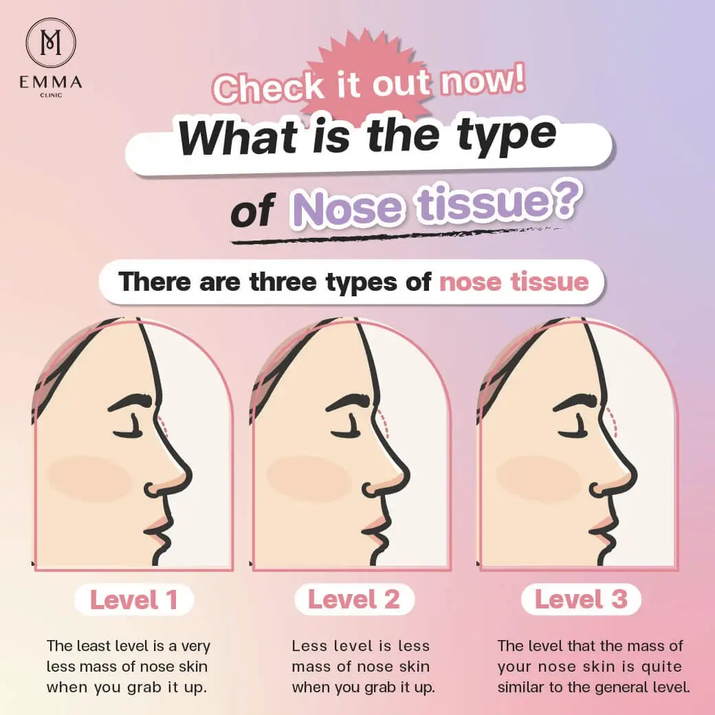 check it now what is the type of nose tissue Nose Surgery EMMA CLINIC