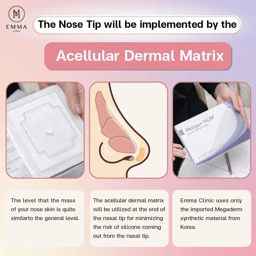 the nose tip will be implemented by the acellular dermal Nose Surgery EMMA CLINIC