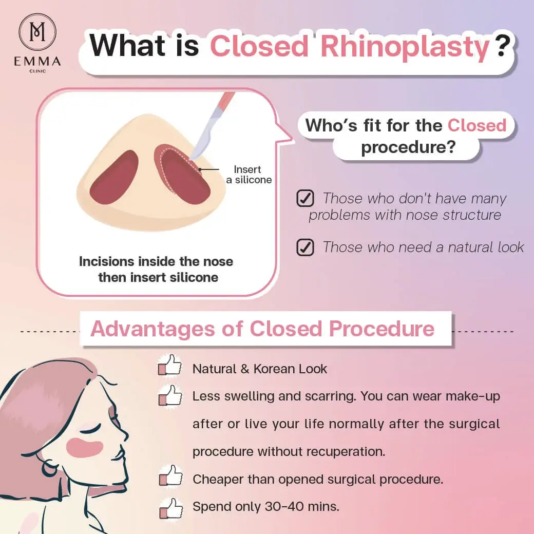 what is closed rhinoplasty Nose Surgery EMMA CLINIC