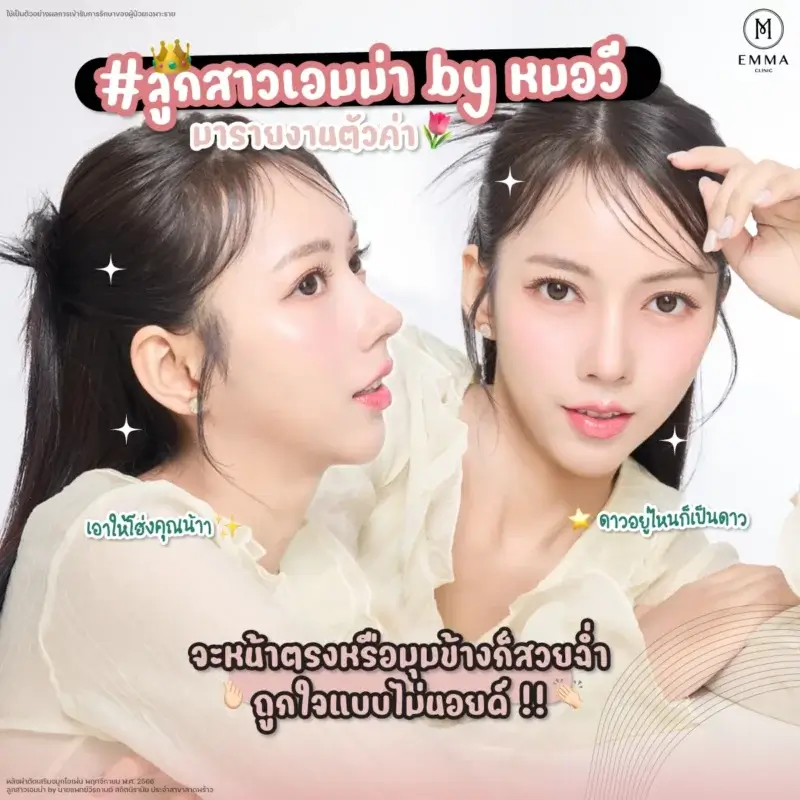 after nose surgry แก้จมูก EMMA CLINIC
